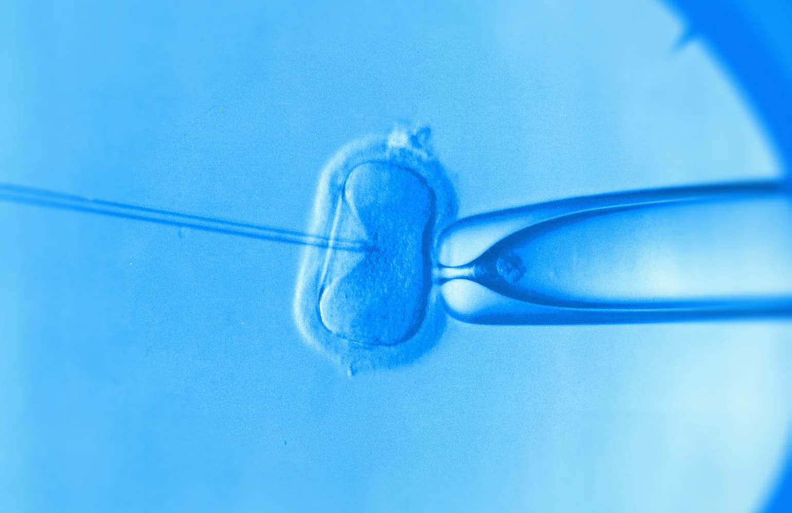 Ivf